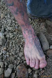 Those wrinkly bits are skin