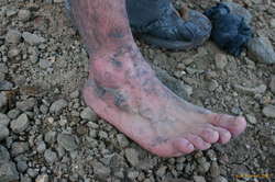 Skin's not meant to dangle like that