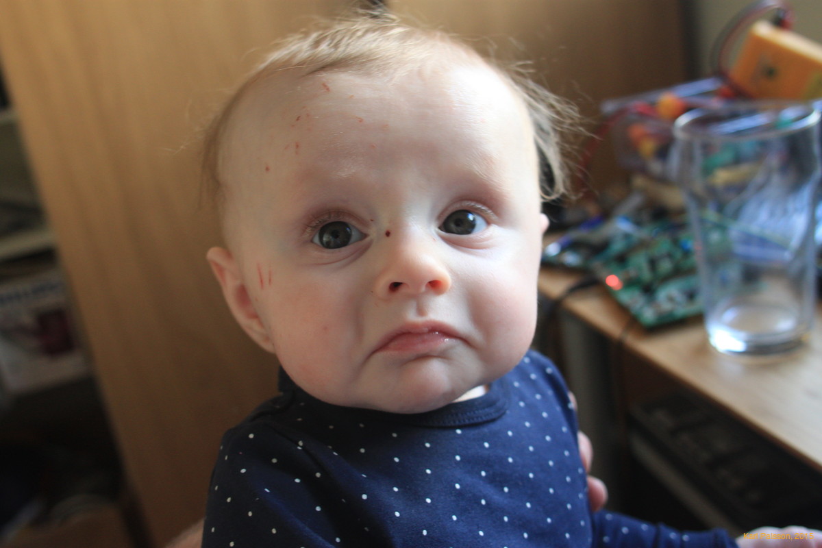 Meh, you should have seen the other guy